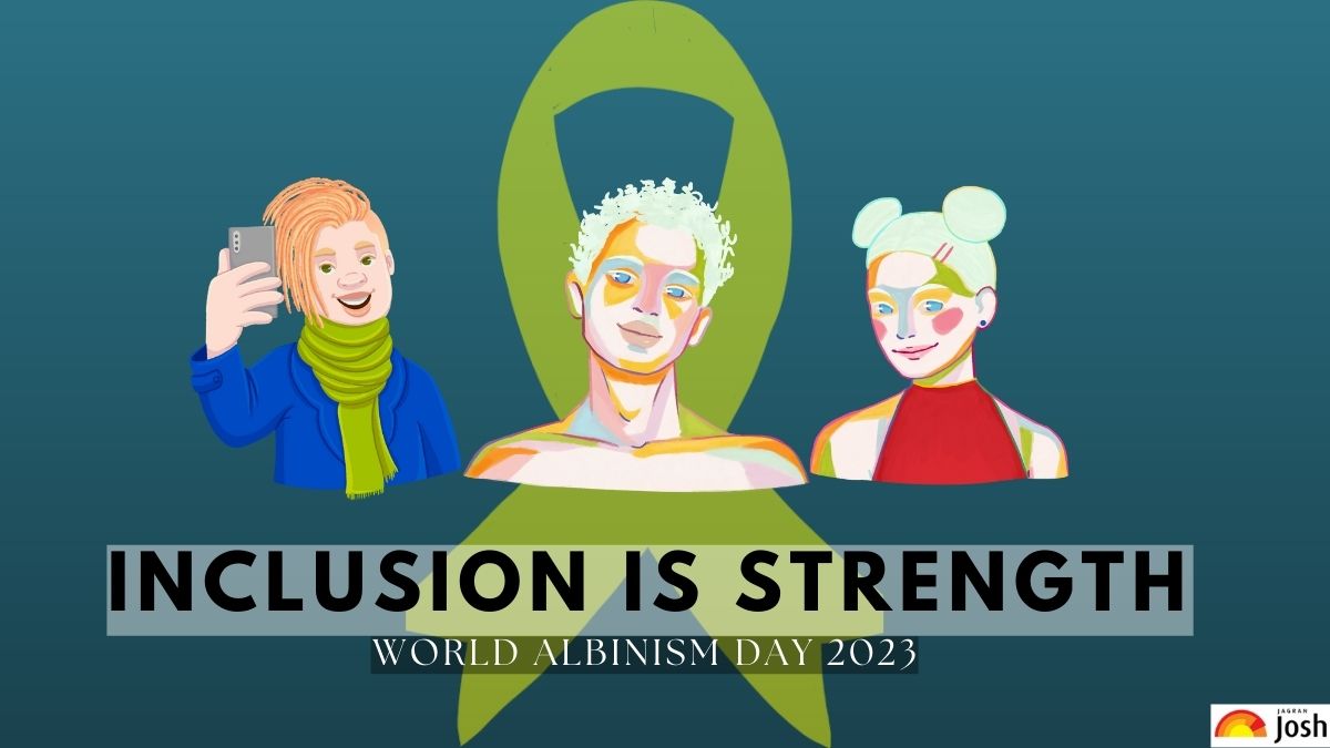 All You Need To Know About Albinism Awareness Day 2023
